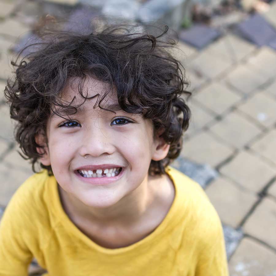 cavities in children