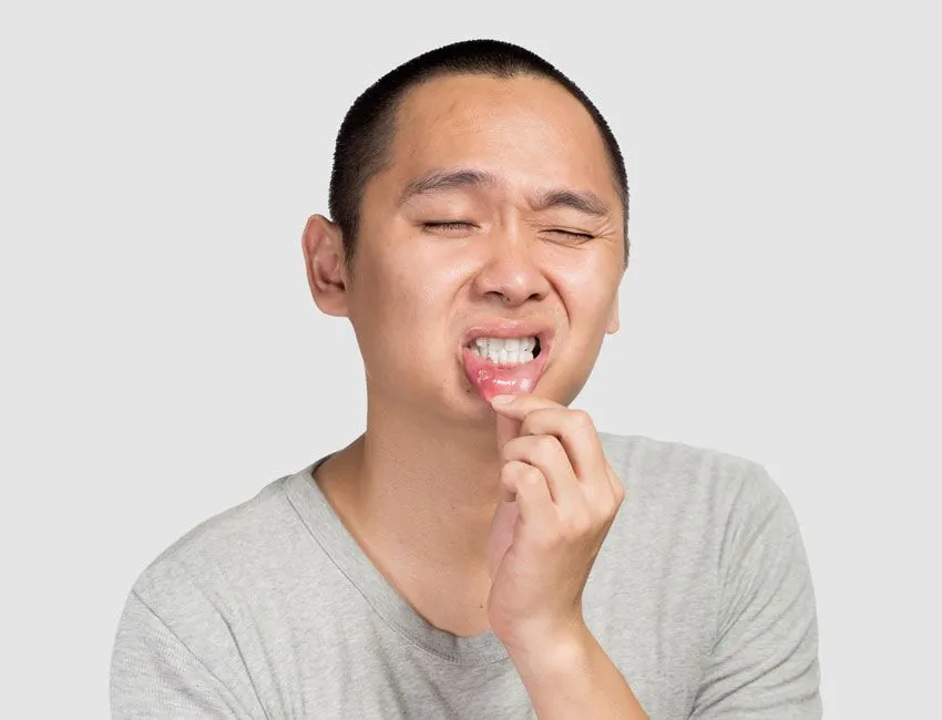 9 Quick Ways to Get Rid of a Canker Sore